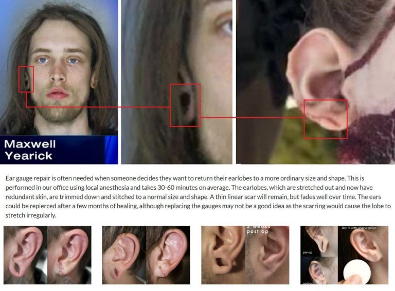 Maxwell Yearick Has Gone Missing Since Trump Rally
